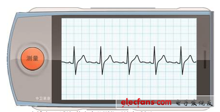 心博士?远程智能心电监测仪（健康手机）