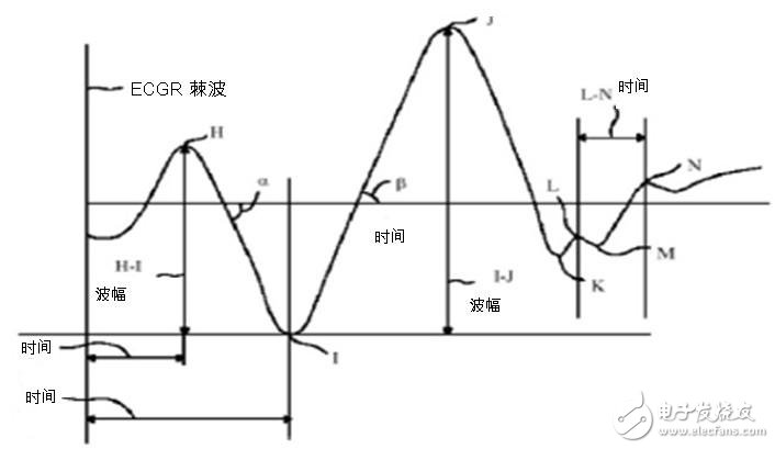 图二：心脏冲击扫描图波形。