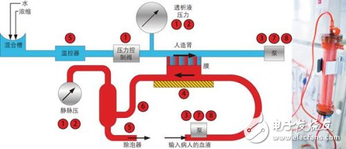 血液透析机要求极其精确地测量患者血压和透析液（清除血流中的毒素）压力