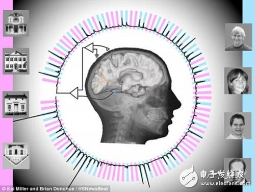 脑电波技术再上一层楼，读心准确率高达95%